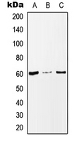 Western blot analysis of MAZ expression in MCF7 (A); Raw264.7 (B); PC12 (C) whole cell lysates.