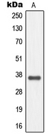 Western blot analysis of MC4 Receptor expression in EOC20 (A) whole cell lysates.