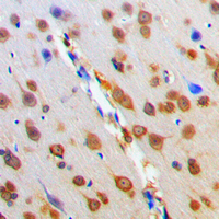 Immunohistochemical analysis of MC4 Receptor staining in human brain formalin fixed paraffin embedded tissue section. The section was pre-treated using heat mediated antigen retrieval with sodium citrate buffer (pH 6.0). The section was then incubated with the antibody at room temperature and detected using an HRP conjugated compact polymer system. DAB was used as the chromogen. The section was then counterstained with haematoxylin and mounted with DPX.