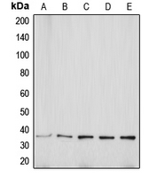Western blot analysis of Aquaporin 5 expression in MCF7 (A); Jurkat (B); SP2/0 (C); PC12 (D); KNRK (E) whole cell lysates.