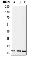 Western blot analysis of MGST2 expression in MCF7 (A); SP2/0 (B); PC12 (C) whole cell lysates.