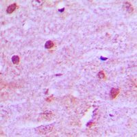 Immunohistochemical analysis of MNAT1 staining in human brain formalin fixed paraffin embedded tissue section. The section was pre-treated using heat mediated antigen retrieval with sodium citrate buffer (pH 6.0). The section was then incubated with the antibody at room temperature and detected using an HRP conjugated compact polymer system. DAB was used as the chromogen. The section was then counterstained with haematoxylin and mounted with DPX.