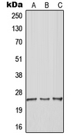 Western blot analysis of RhoGDI gamma expression in Jurkat (A); MCF7 (B); Raw264.7 (C) whole cell lysates.