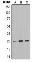 Western blot analysis of MPZ expression in HeLa (A); SP2/0 (B); PC12 (C) whole cell lysates.