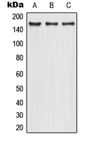 Western blot analysis of CD206 expression in HepG2 (A); Caco2 (B); NIH3T3 (C) whole cell lysates.