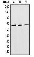 Western blot analysis of MTHFR expression in HEK293 (A); Jurkat (B); A549 (C) whole cell lysates.