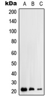 Western blot analysis of RhoH expression in HEK293T (A); HepG2 (B); Jurkat (C) whole cell lysates.