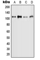 Western blot analysis of MYBL2 (pS577) expression in MCF7 (A); HeLa (B); mouse liver (C); rat liver (D) whole cell lysates.