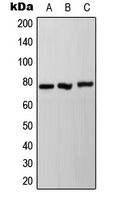 Western blot analysis of NDUFS1 expression in HeLa (A); SP2/0 (B); PC12 (C) whole cell lysates.