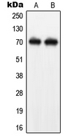 Western blot analysis of NEFL expression in SHSY5Y (A); Jurkat (B) whole cell lysates.