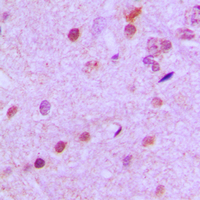 Immunohistochemical analysis of NEUROD2 staining in human brain formalin fixed paraffin embedded tissue section. The section was pre-treated using heat mediated antigen retrieval with sodium citrate buffer (pH 6.0). The section was then incubated with the antibody at room temperature and detected using an HRP conjugated compact polymer system. DAB was used as the chromogen. The section was then counterstained with haematoxylin and mounted with DPX.