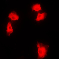 Immunofluorescent analysis of NF-kappaB p100 staining in HEK293T cells. Formalin-fixed cells were permeabilized with 0.1% Triton X-100 in TBS for 5-10 minutes and blocked with 3% BSA-PBS for 30 minutes at room temperature. Cells were probed with the primary antibody in 3% BSA-PBS and incubated overnight at 4 C in a humidified chamber. Cells were washed with PBST and incubated with a DyLight 594-conjugated secondary antibody (red) in PBS at room temperature in the dark. DAPI was used to stain the cell nuclei (blue).