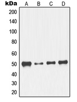 Western blot analysis of NFYC expression in K562 (A); NIH3T3 (B); HeLa (C); Jurkat (D) whole cell lysates.