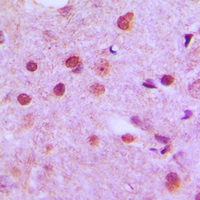 Immunohistochemical analysis of NFYC staining in human brain formalin fixed paraffin embedded tissue section. The section was pre-treated using heat mediated antigen retrieval with sodium citrate buffer (pH 6.0). The section was then incubated with the antibody at room temperature and detected using an HRP conjugated compact polymer system. DAB was used as the chromogen. The section was then counterstained with haematoxylin and mounted with DPX.