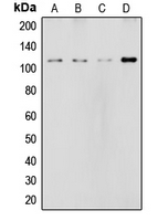 Western blot analysis of NOTCH2 expression in HeLa (A); MCF7 (B); rat liver (C); NIH3T3 (D) whole cell lysates.