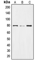 Western blot analysis of NOTCH2 expression in HepG2 colchicine-treated (A); Raw264.7 colchicine-treated (B); rat liver (C) whole cell lysates.