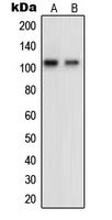 Western blot analysis of OCRL expression in HeLa (A); KNRK (B) whole cell lysates.