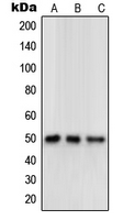 Western blot analysis of Delta Opioid Receptor expression in human brain (A); mouse brain (B); rat brain (C) whole cell lysates.