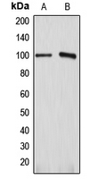 Western blot analysis of ATP1A1 expression in HEK293T (A); HeLa (B) whole cell lysates.