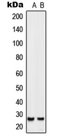 Western blot analysis of SIX6 expression in Jurkat (A); NIH3T3 (B) whole cell lysates.