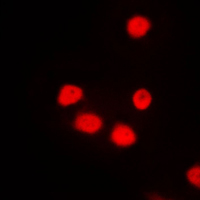 Immunofluorescent analysis of SIX6 staining in NIH3T3 cells. Formalin-fixed cells were permeabilized with 0.1% Triton X-100 in TBS for 5-10 minutes and blocked with 3% BSA-PBS for 30 minutes at room temperature. Cells were probed with the primary antibody in 3% BSA-PBS and incubated overnight at 4 C in a humidified chamber. Cells were washed with PBST and incubated with a DyLight 594-conjugated secondary antibody (red) in PBS at room temperature in the dark. DAPI was used to stain the cell nuclei (blue).