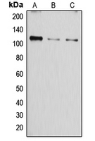 Western blot analysis of SERCA1 expression in A549 (A); mouse muscle (B); rat muscle (C) whole cell lysates.
