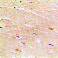 Immunohistochemical analysis of SERCA1 staining in human muscle formalin fixed paraffin embedded tissue section. The section was pre-treated using heat mediated antigen retrieval with sodium citrate buffer (pH 6.0). The section was then incubated with the antibody at room temperature and detected using an HRP conjugated compact polymer system. DAB was used as the chromogen. The section was then counterstained with haematoxylin and mounted with DPX.