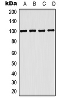 Western blot analysis of CD203c expression in MDAMB453 (A); Jurkat (B); SP2/0 (C); H9C2 (D) whole cell lysates.