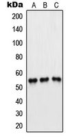 Western blot analysis of PFKFB1/4 expression in Jurkat (A); H1299 (B); HeLa (C) whole cell lysates.