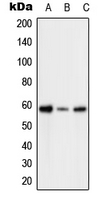 Western blot analysis of PFKFB2 (pS483) expression in HeLa H2O2-treated (A); SP2/0 H2O2-treated (B); H9C2 H2O2-treated (C) whole cell lysates.