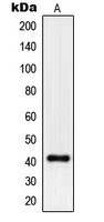 Western blot analysis of Pepsin A expression in HepG2 (A) whole cell lysates.