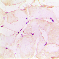 Immunohistochemical analysis of Pepsin A staining in human muscle formalin fixed paraffin embedded tissue section. The section was pre-treated using heat mediated antigen retrieval with sodium citrate buffer (pH 6.0). The section was then incubated with the antibody at room temperature and detected using an HRP conjugated compact polymer system. DAB was used as the chromogen. The section was then counterstained with haematoxylin and mounted with DPX.