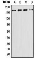 Western blot analysis of PI3K C2 gamma expression in CEM (A); HeLa (B); NIH3T3 (C); PC12 (D) whole cell lysates.