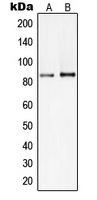 Western blot analysis of PI3K p85 beta expression in HepG2 (A); Raji (B) whole cell lysates.