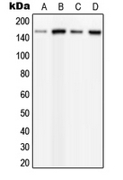 Western blot analysis of PLC beta 3 (pS537) expression in HeLa PMA-treated (A); MCF7 UV-treated (B); mouse brain (C); rat brain (D) whole cell lysates.
