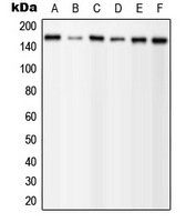 Western blot analysis of PLC gamma 1 (pY1253) expression in MCF7 EGF-treated (A); A431 (B); mouse brain (C); mouse liver (D); H9C2 EGF-treated (E) whole cell lysates.