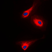 Immunofluorescent analysis of PLC gamma 1 (pY1253) staining in A431 cells. Formalin-fixed cells were permeabilized with 0.1% Triton X-100 in TBS for 5-10 minutes and blocked with 3% BSA-PBS for 30 minutes at room temperature. Cells were probed with the primary antibody in 3% BSA-PBS and incubated overnight at 4 C in a humidified chamber. Cells were washed with PBST and incubated with a DyLight 594-conjugated secondary antibody (red) in PBS at room temperature in the dark. DAPI was used to stain the cell nuclei (blue).