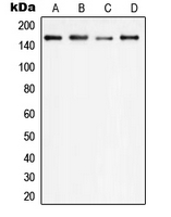 Western blot analysis of PLC gamma 1 expression in HEK293T (A); HeLa (B); SP2/0 (C); PC12 (D) whole cell lysates.