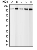 Western blot analysis of PLC gamma 2 (pY1217) expression in HEK293T EGF-treated (A); A431 (B); NIH3T3 (C); SP2/0 EGF-treated (D); H9C2 EGF-treated (E) whole cell lysates.