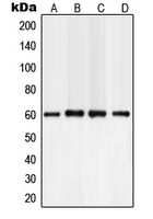 Western blot analysis of PLC gamma 2 expression in A549 (A); NIH3T3 (B); mouse brain (C); rat brain (D) whole cell lysates.