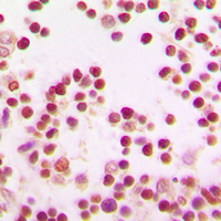 Immunohistochemical analysis of BACH1 staining in human tonsil formalin fixed paraffin embedded tissue section. The section was pre-treated using heat mediated antigen retrieval with sodium citrate buffer (pH 6.0). The section was then incubated with the antibody at room temperature and detected using an HRP conjugated compact polymer system. DAB was used as the chromogen. The section was then counterstained with haematoxylin and mounted with DPX.