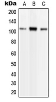 Western blot analysis of Phospholipase D2 (pY169) expression in HEK293T TNFa-treated (A); NIH3T3 TNFa-treated (B); H9C2 TNFa-treated (C) whole cell lysates.