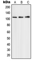 Western blot analysis of PMS1 expression in HepG2 (A); Molt4 (B); A549 (C) whole cell lysates.