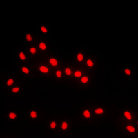 Immunofluorescent analysis of BACH1 staining in MCF7 cells. Formalin-fixed cells were permeabilized with 0.1% Triton X-100 in TBS for 5-10 minutes and blocked with 3% BSA-PBS for 30 minutes at room temperature. Cells were probed with the primary antibody in 3% BSA-PBS and incubated overnight at 4 C in a humidified chamber. Cells were washed with PBST and incubated with a DyLight 594-conjugated secondary antibody (red) in PBS at room temperature in the dark. DAPI was used to stain the cell nuclei (blue).