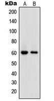 Western blot analysis of DNA Polymerase epsilon 2 expression in HL60 (A); HeLa (B) whole cell lysates.