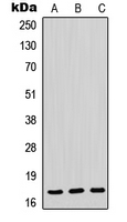 Western blot analysis of POLR2H expression in HeLa (A); mouse liver (B); rat liver (C) whole cell lysates.