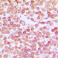 Immunohistochemical analysis of OCT1 staining in human tonsil formalin fixed paraffin embedded tissue section. The section was pre-treated using heat mediated antigen retrieval with sodium citrate buffer (pH 6.0). The section was then incubated with the antibody at room temperature and detected using an HRP conjugated compact polymer system. DAB was used as the chromogen. The section was then counterstained with haematoxylin and mounted with DPX.