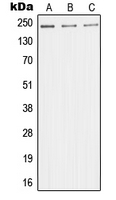 Western blot analysis of TRAP220 expression in HeLa (A); HuvEc (B); Jurkat (C) whole cell lysates.