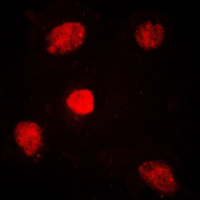 Immunofluorescent analysis of TRAP220 staining in HuvEc cells. Formalin-fixed cells were permeabilized with 0.1% Triton X-100 in TBS for 5-10 minutes and blocked with 3% BSA-PBS for 30 minutes at room temperature. Cells were probed with the primary antibody in 3% BSA-PBS and incubated overnight at 4 C in a humidified chamber. Cells were washed with PBST and incubated with a DyLight 594-conjugated secondary antibody (red) in PBS at room temperature in the dark. DAPI was used to stain the cell nuclei (blue).