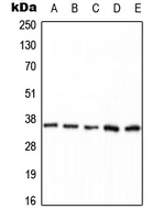 Western blot analysis of PPP2CA (pY307) expression in HEK293T EGF-treated (A); MCF7 (B); mouse brain (C); NIH3T3 (D); H9C2 EGF-treated (E) whole cell lysates.